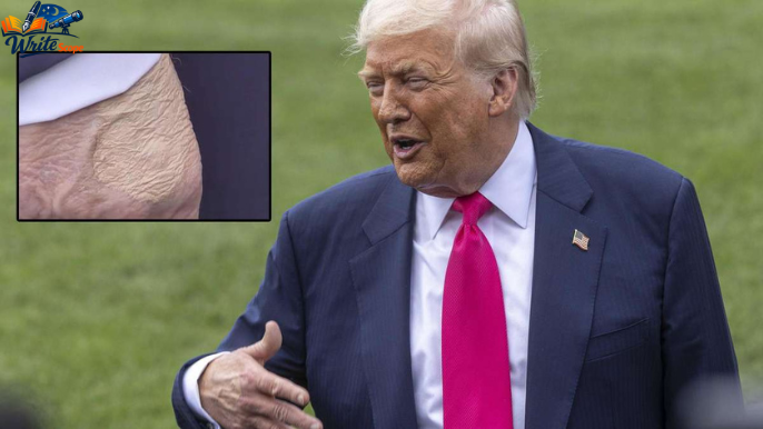 trumps gesundheit aktuell
