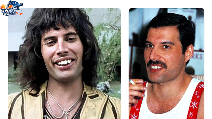 freddie mercury zähne
