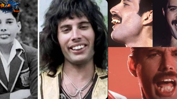 freddie mercury zähne
